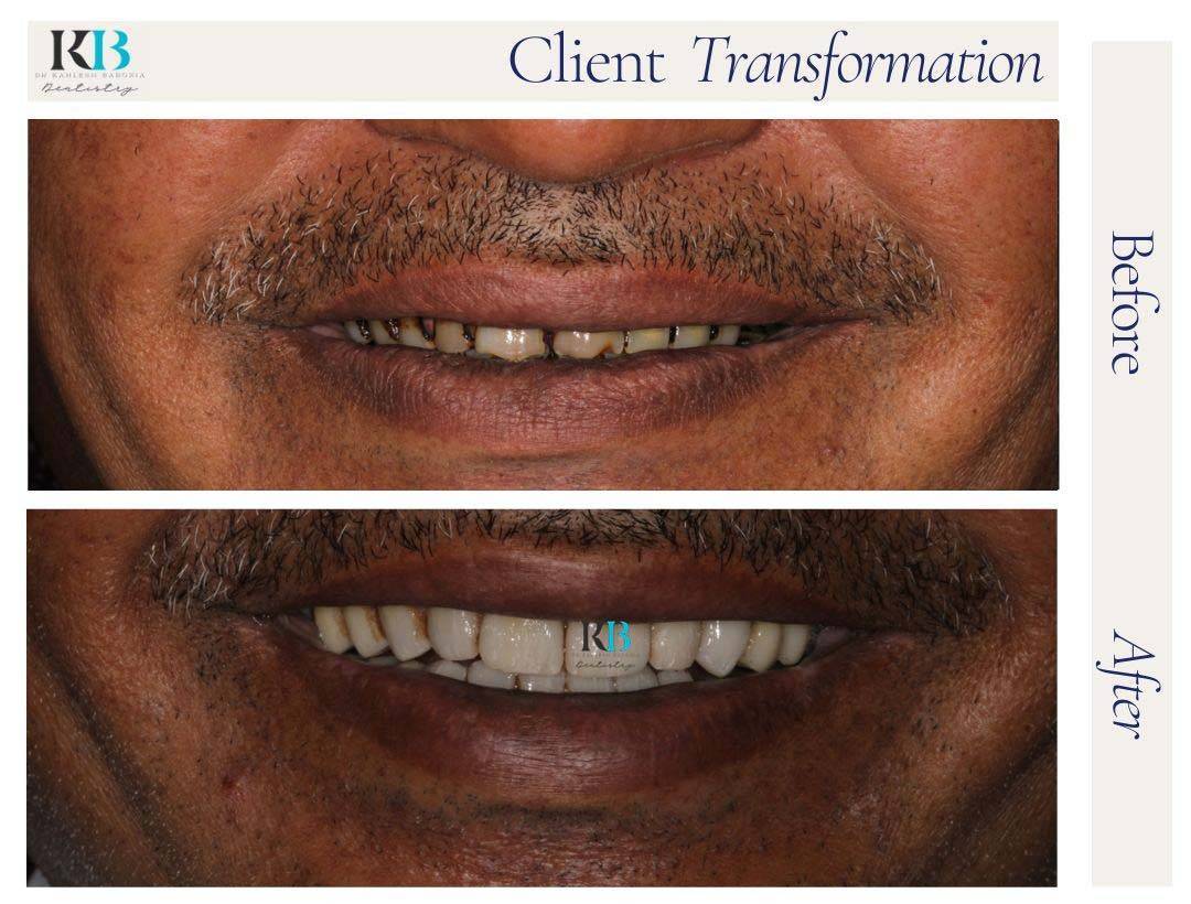 Before and After Instagram Post (1) Before and After Instagram Post (1)