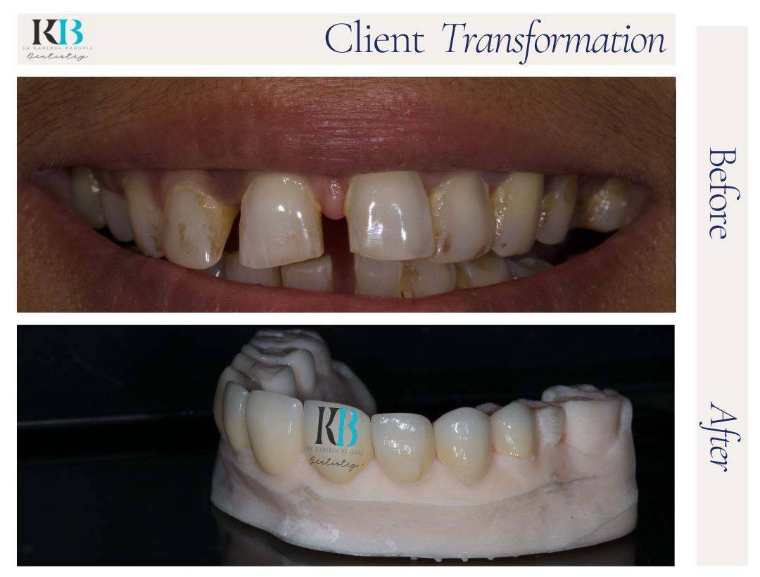 Before and After Instagram Post (10) Before and After Instagram Post (10)