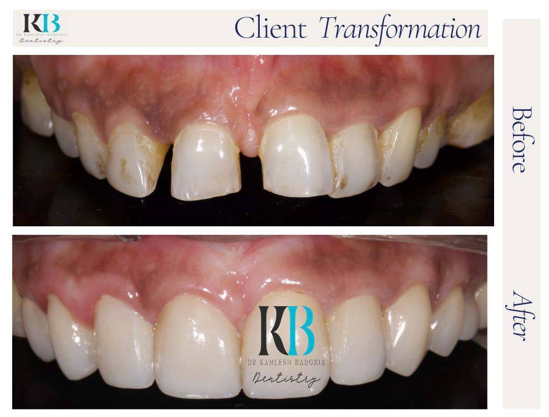 Before and After Instagram Post (11) Before and After Instagram Post (11)