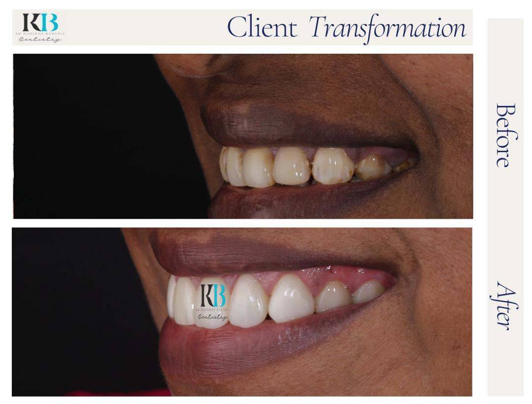 Before and After Instagram Post (12) Before and After Instagram Post (12)