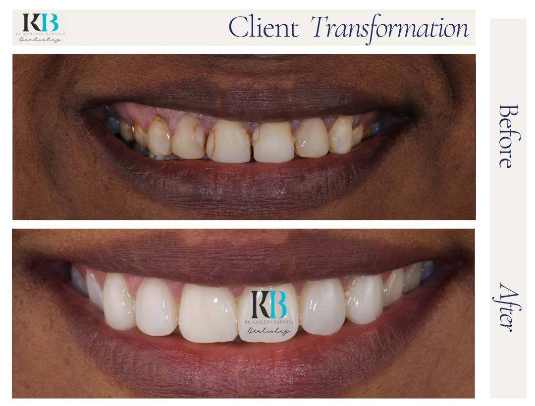 Before and After Instagram Post (13) Before and After Instagram Post (13)