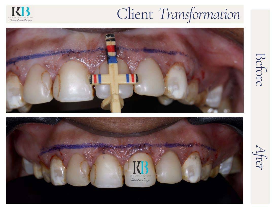 Before and After Instagram Post (14) Before and After Instagram Post (14)