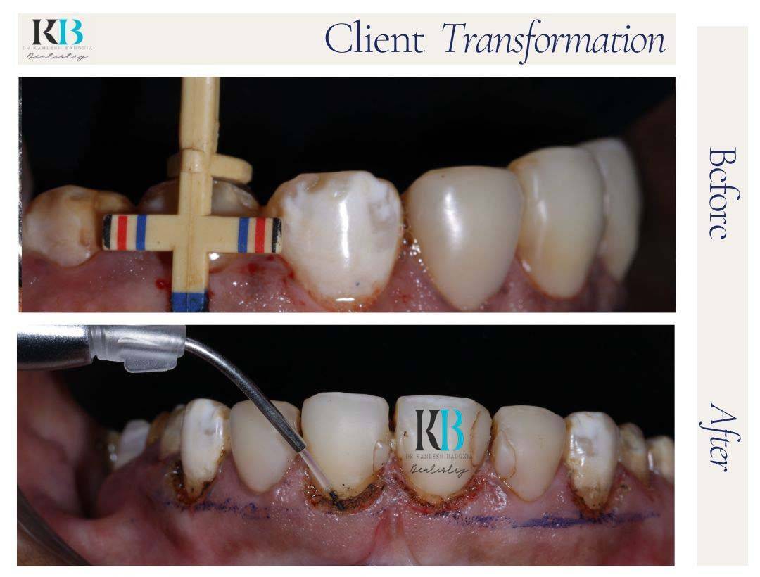 Before and After Instagram Post (15) Before and After Instagram Post (15)