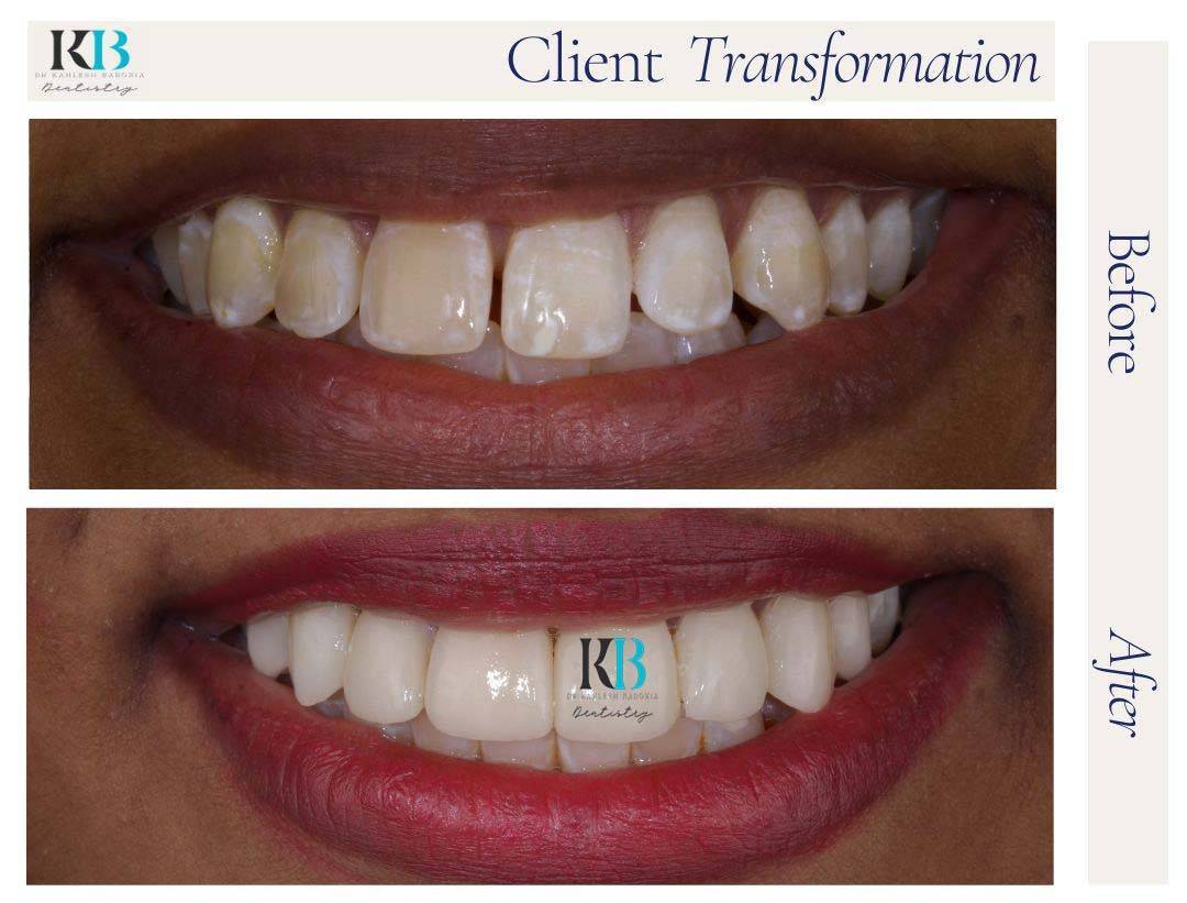 Before and After Instagram Post (16) Before and After Instagram Post (16)