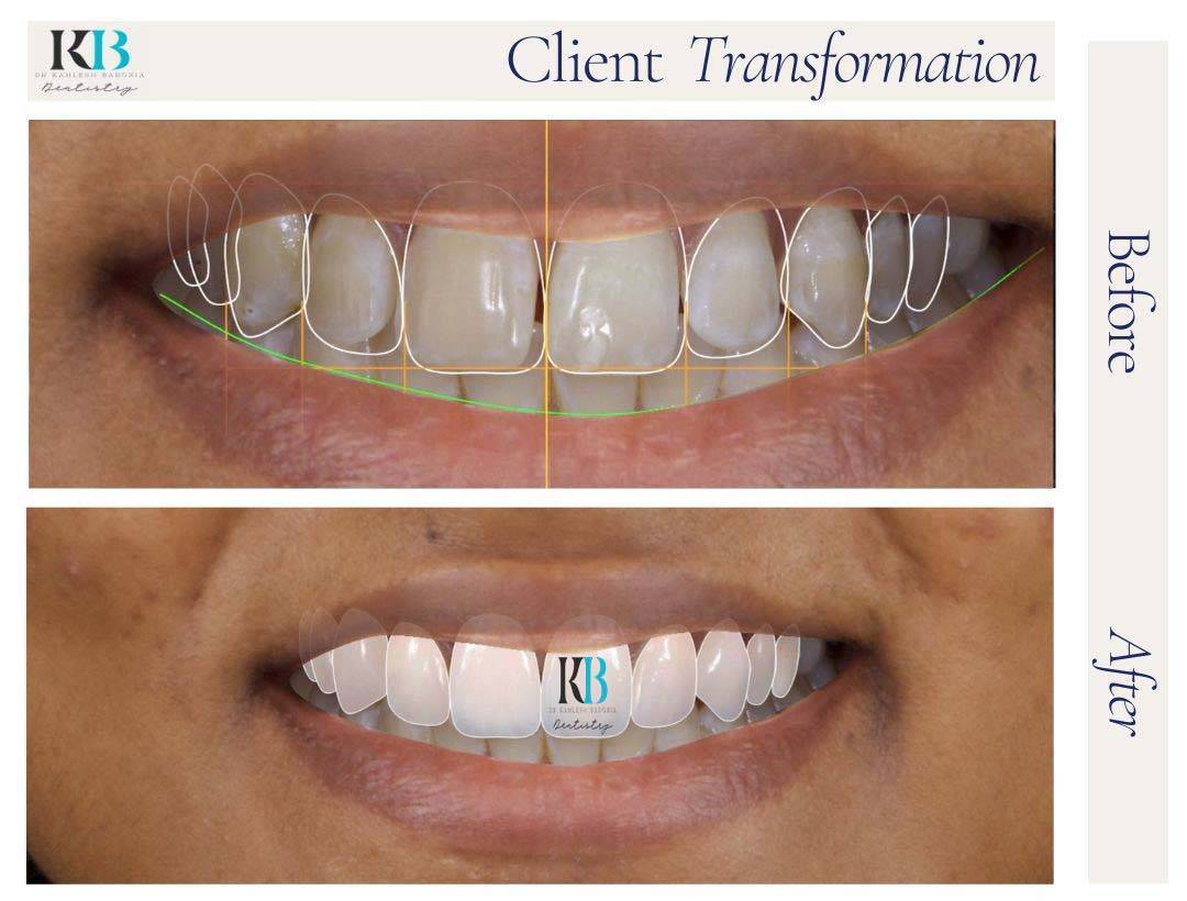 Before and After Instagram Post (17) Before and After Instagram Post (17)