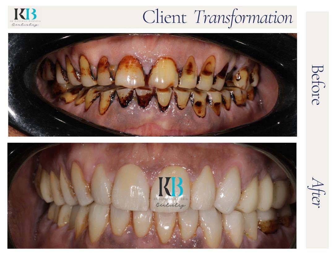 Before and After Instagram Post Before and After Instagram Post