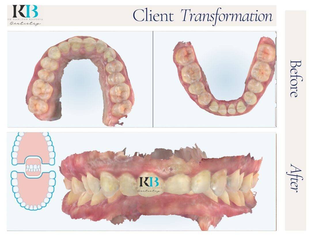 Before and After Instagram Post - 1 Before and After Instagram Post - 1