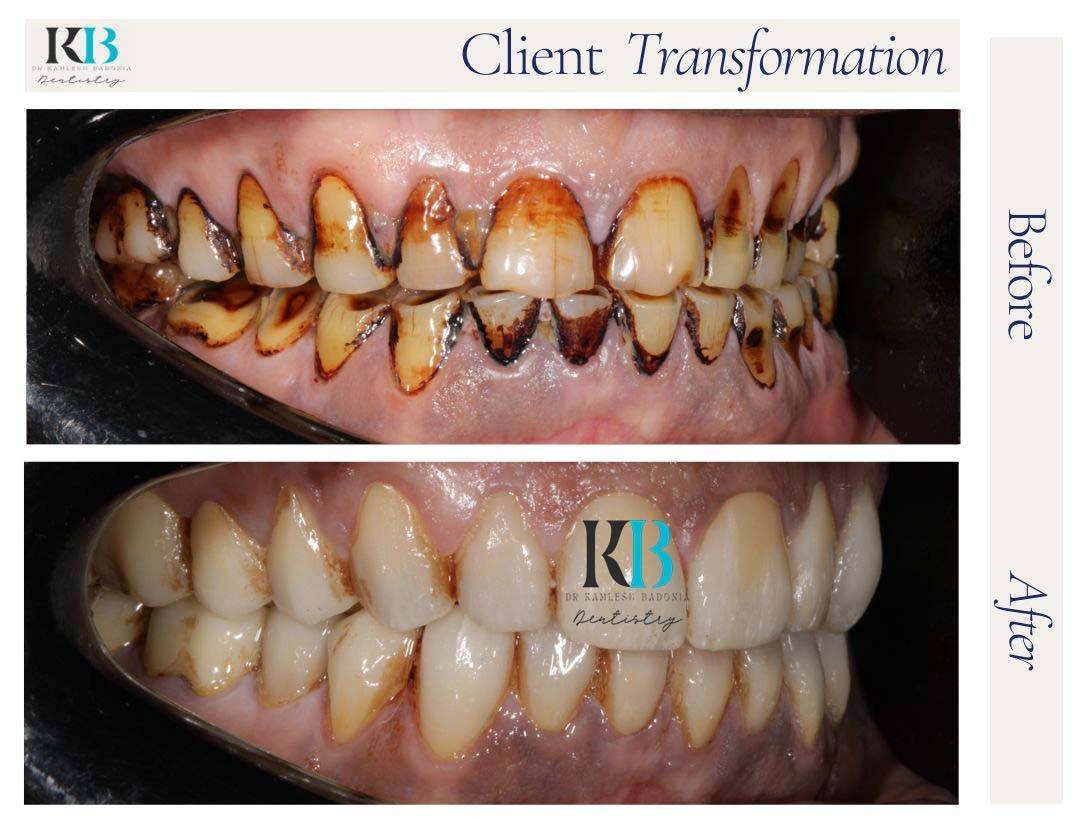 Before and After Instagram Post (3) Before and After Instagram Post (3)