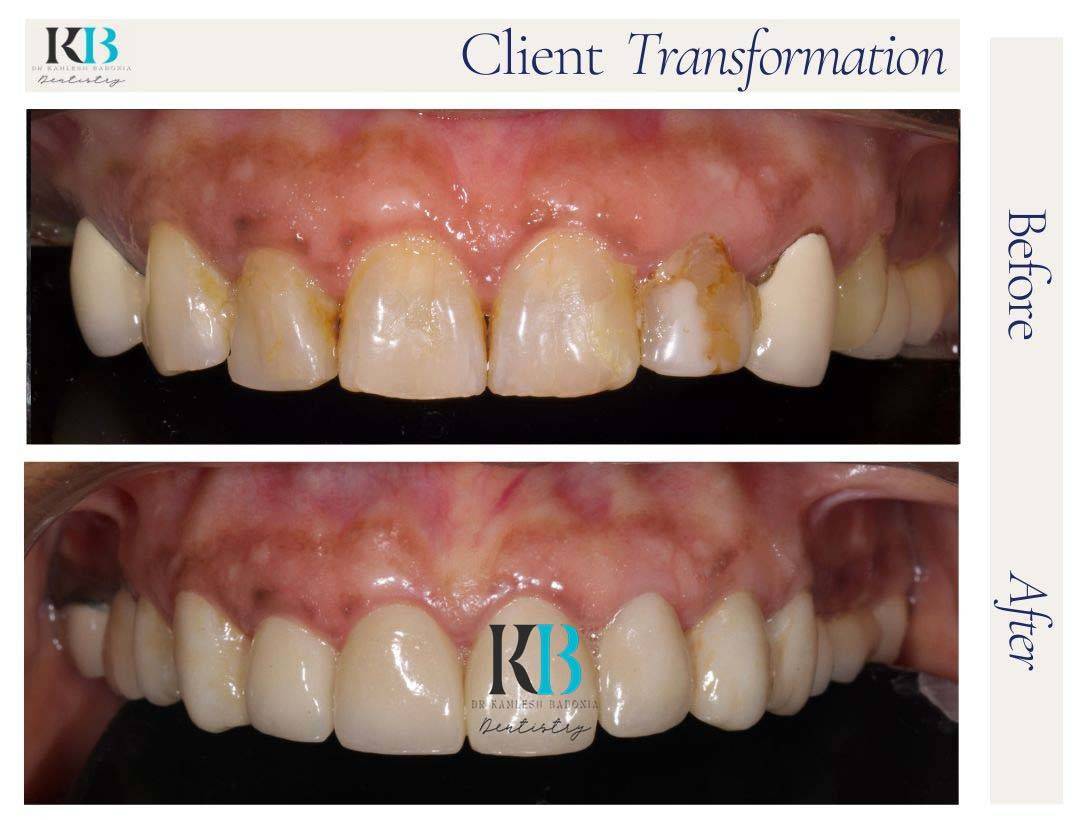 Before and After Instagram Post (4) Before and After Instagram Post (4)