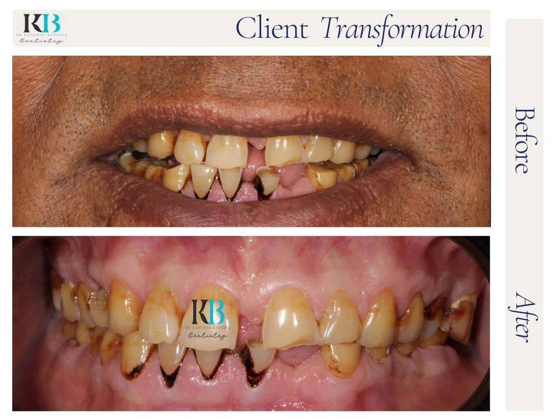 Before and After Instagram Post (6) Before and After Instagram Post (6)