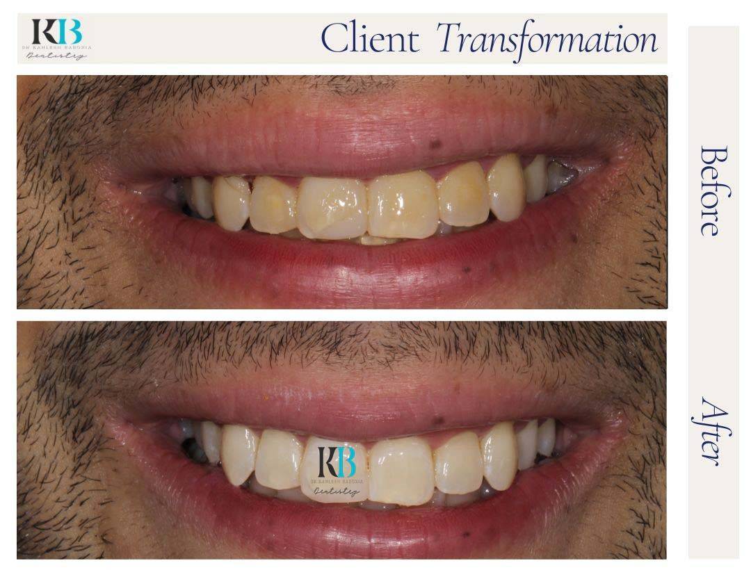 Before and After Instagram Post (7) Before and After Instagram Post (7)