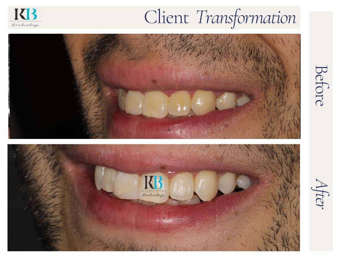 Before and After Instagram Post (8) Before and After Instagram Post (8)