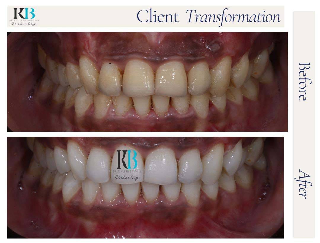 Before and After Instagram Post (9) Before and After Instagram Post (9)